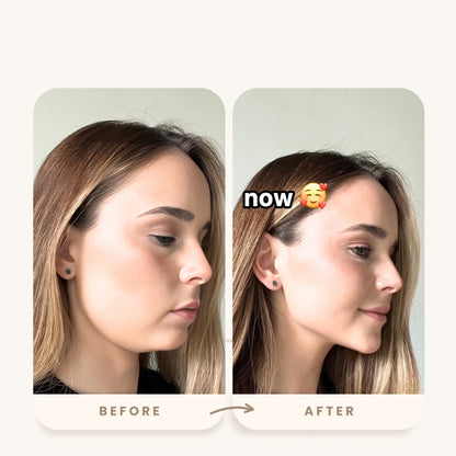 Faltenentferner Gesichtsmassager