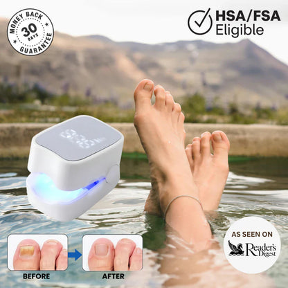 Sunbaz™ – Lasergerät gegen Nagelpilz